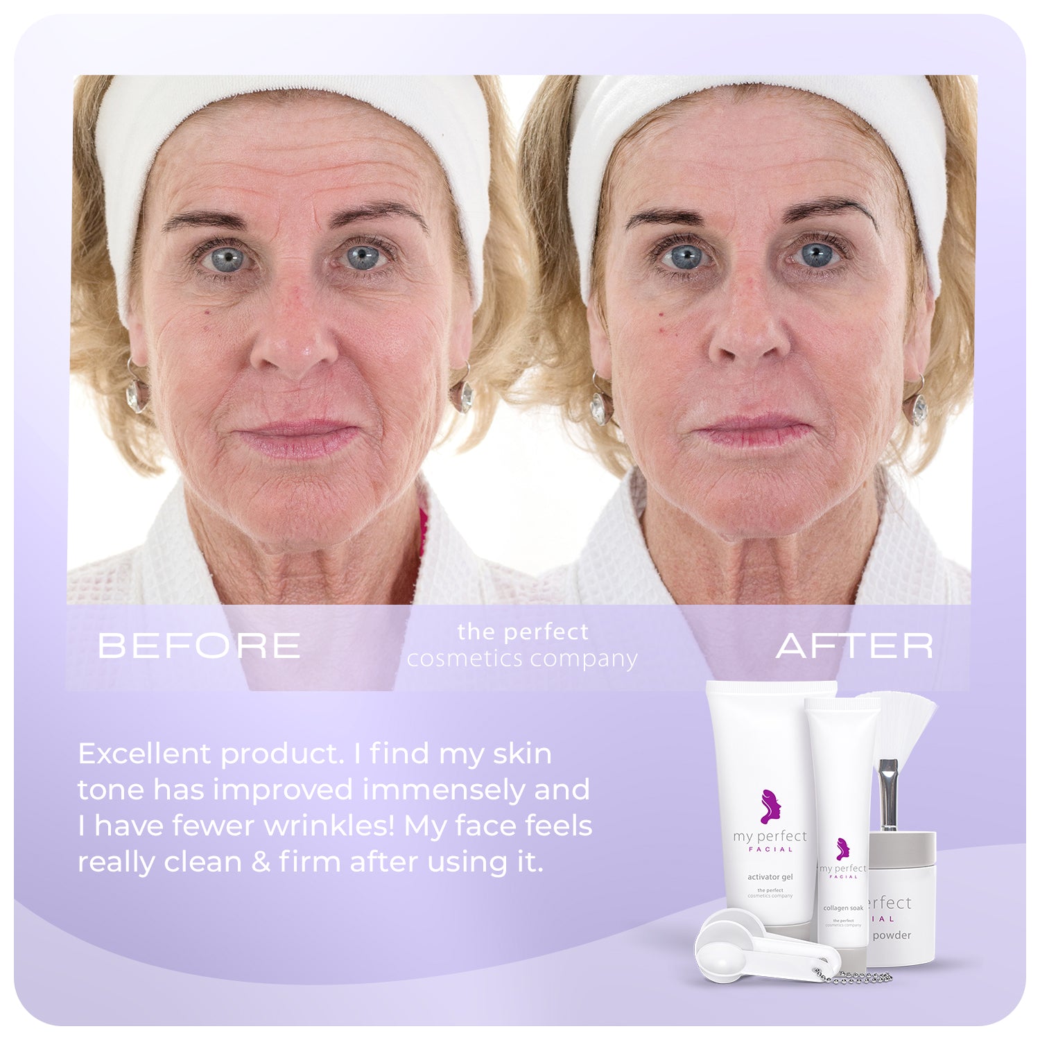Before and after My Perfect Facial showing smoother skin, reduced fine lines and wrinkles, lifting and firming facial appearance