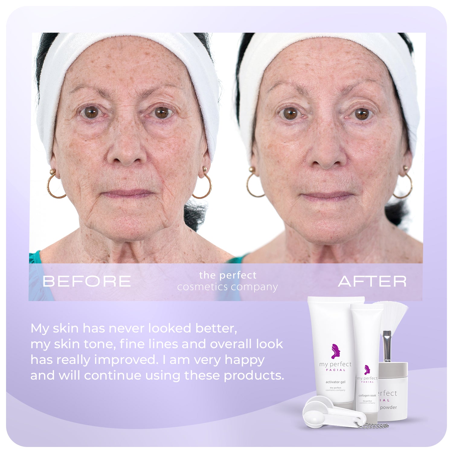 Before and after My Perfect Facial showing smoother skin, reduced fine lines and wrinkles, lifting and firming facial appearance