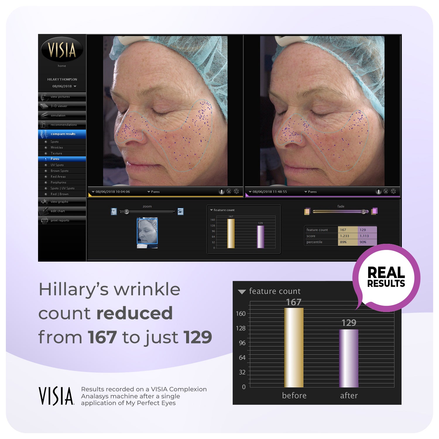 My Perfect Facial